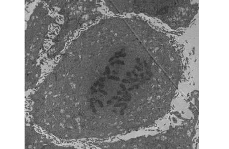 奈米級超薄切片機Ultramicrotome套件服務